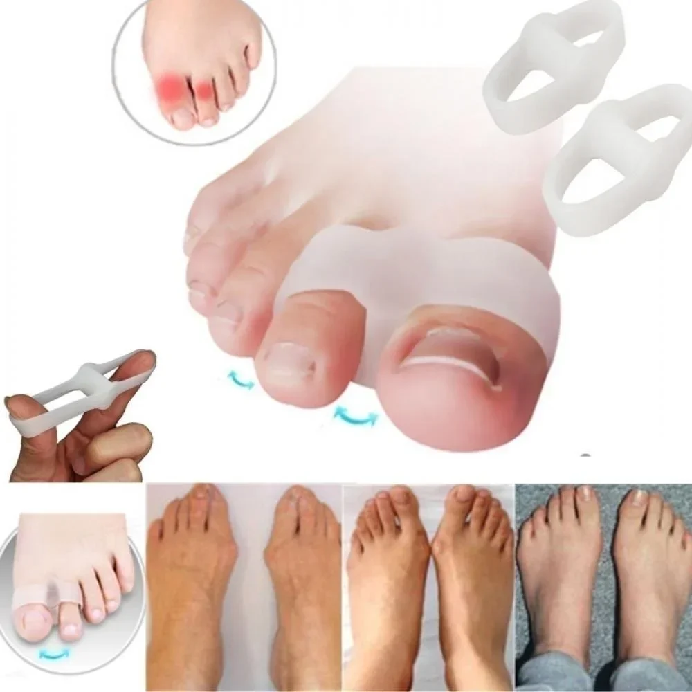 2 Holes Bunion Corrector Pain  - огляд і ціна Correction Fluid White